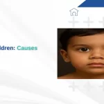 Strabismus in Children