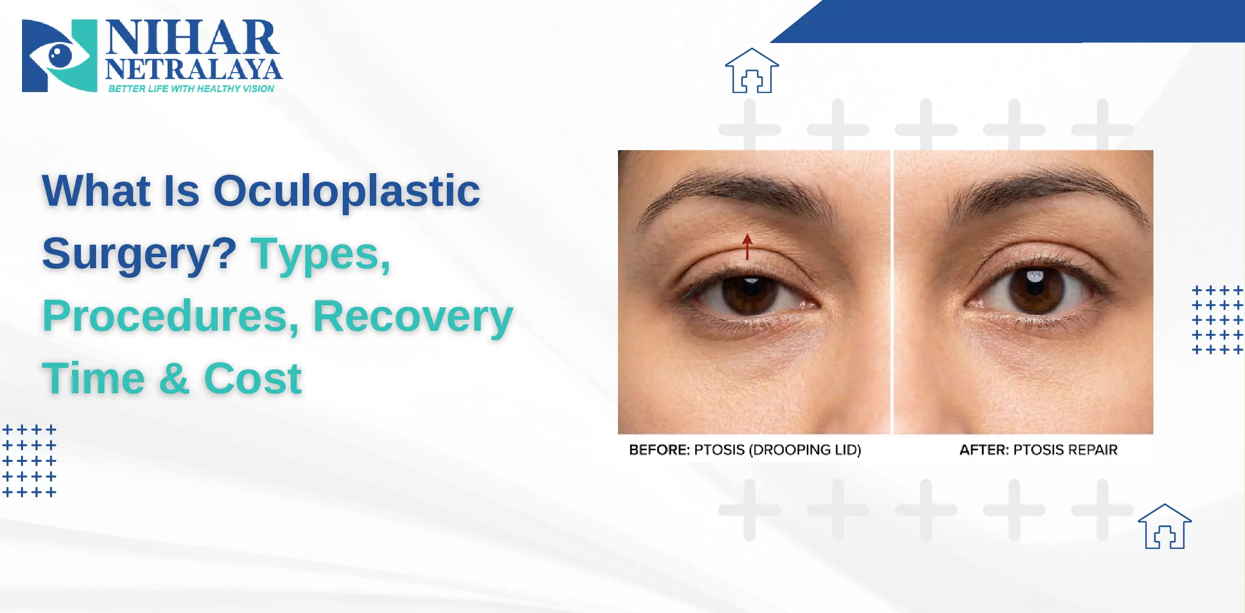What Is Oculoplastic Surgery?