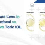 Best Cataract Lens in India
