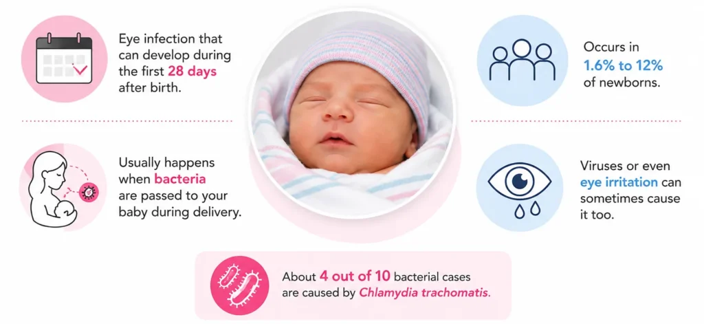 Newborn conjunctivitis infographic