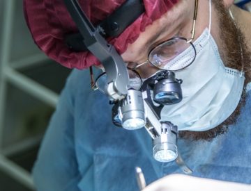 Yag Laser Treatment